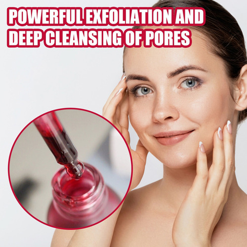 Ee Solucion Exfoliante Profunda Anti Acne, Acido Salicilico