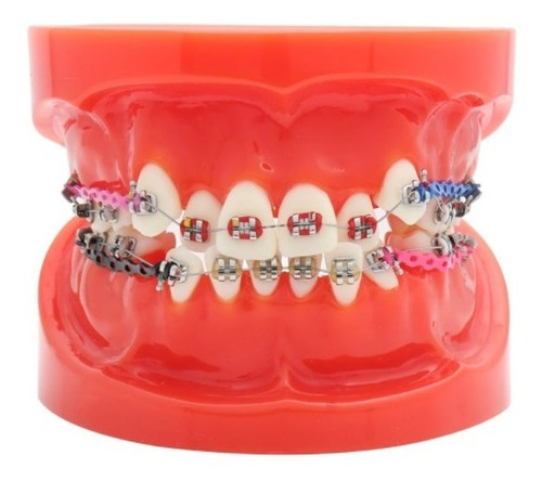 Modelo De Ortodoncia Tipodonto Brackets Dental Dentistas