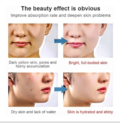 Masajeador Lifting Facial