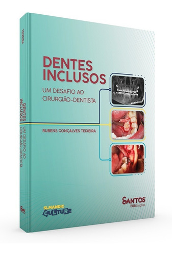 Livro Dentes Inclusos Um Desafio Ao Cirurgião-dentista