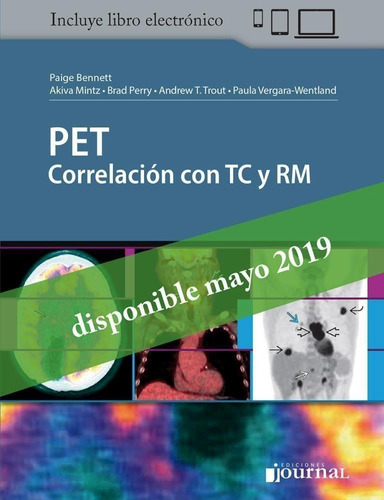 Pet Correlacion Con Tc Y Rm
