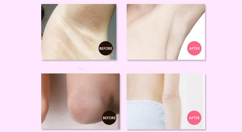 Crema Aclarante Codos Axilas Zonas Íntimas