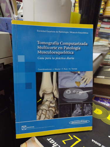 Tomografía Computarizada Multicorte En Patología Musculoesqu