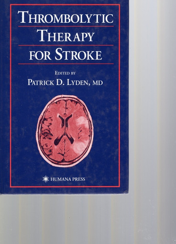 Thrombolytic Therapy For Stroke