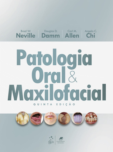 Patologia Oral E Maxilofacial, De Brad W. Neville. Editorial Gen Guanabara Koogan, Capa Dura, Edição 5 Em Português, 2025