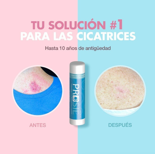 Imagen 2 de 2 de Prosil Tratamiento Profesional Cicatrices 4,25 Gr