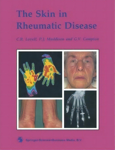 The Skin In Rheumatic Disease, De C. R. Lovell. Editorial Chapman Hall, Tapa Blanda En Inglés