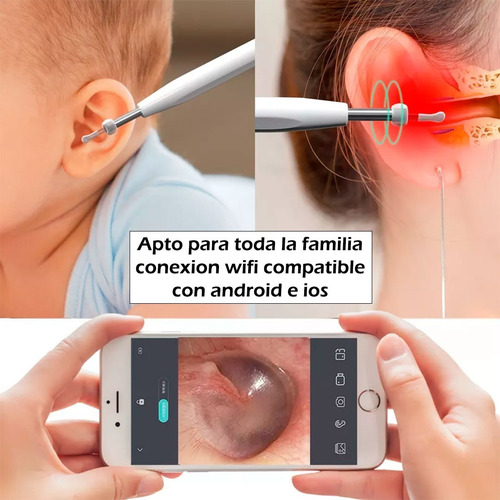 Limpiador De Oidos Con Camara 1080p Kit Eliminacion De Cera