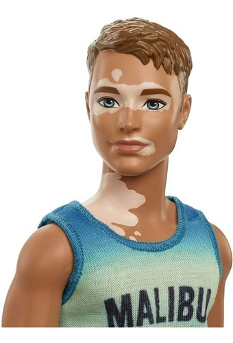 Ken Barbie Fashionistas #192 Vitiligo Cabello Castaño Malibu