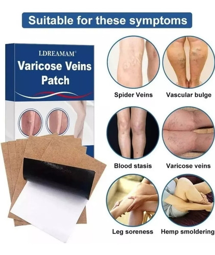 Parches Para Aliviar El Dolor En Personas Con Varices 10 Pzs