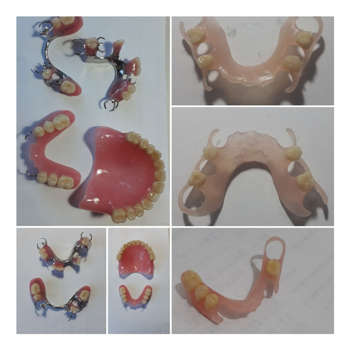 Protesis Dentales Y Flexibles A Domicilio