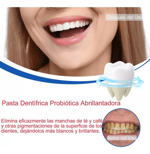 Paquete De 3 Pastas Dentales Blanqueadoras Probióticas Sp6 1