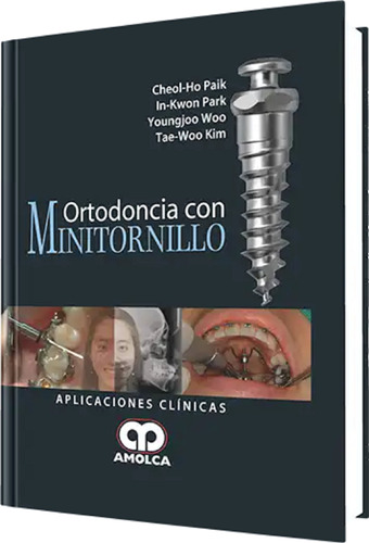 Ortodoncia Con Minitornillo Aplicaciones Clínicas Paik