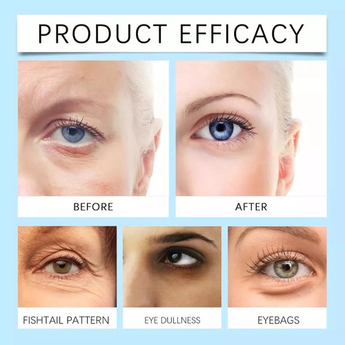- Parches For Debajo De Los Ojos: 60 Piezas, Parches De