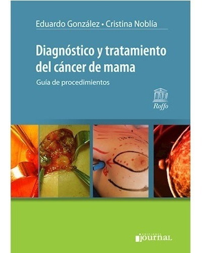 Diagnostico Y Tratamiento Del Cancer De Mama
