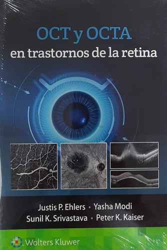 Oct Y Octa En Trastornos De La Retina, De Ehlers, J.., Vol. N/a. Editorial Wolters Kluwer, Tapa Blanda En Español, 2021