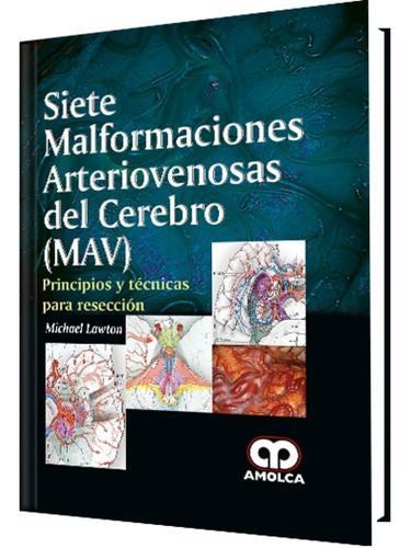 Lawton 7mav Siete Malformaciones Arteriovenosas Del Cerebro