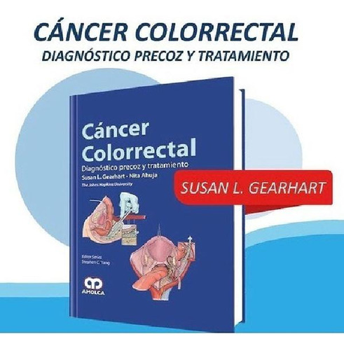 Libro - Cancer Colorrectal Diagnóstico Precoz Y Tratamiento