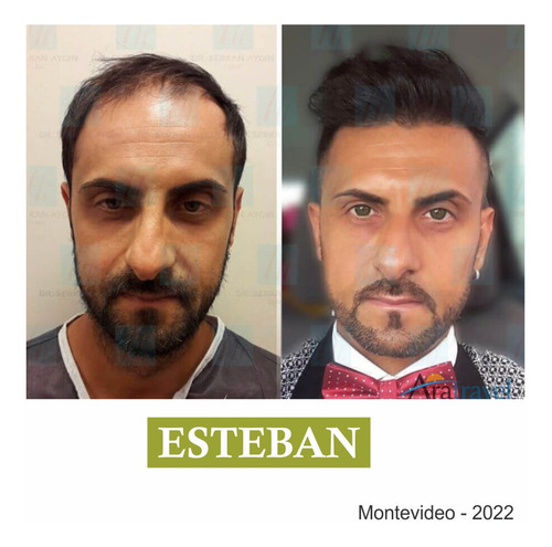 Anticaída Loción Cabello. Biotina + Cisteína 60ml