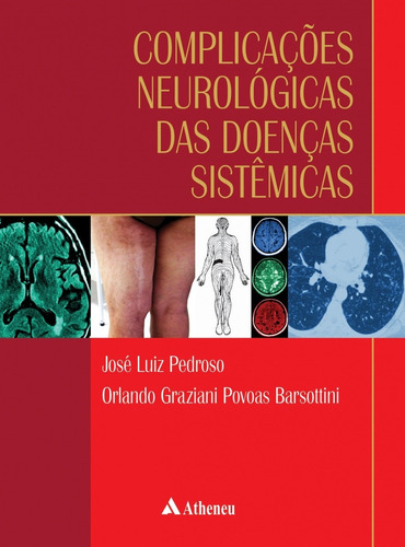 Complicações neurológicas das doenças sistêmicas, de Pedroso, José Luiz. Editora Atheneu Ltda, capa dura em português, 2016