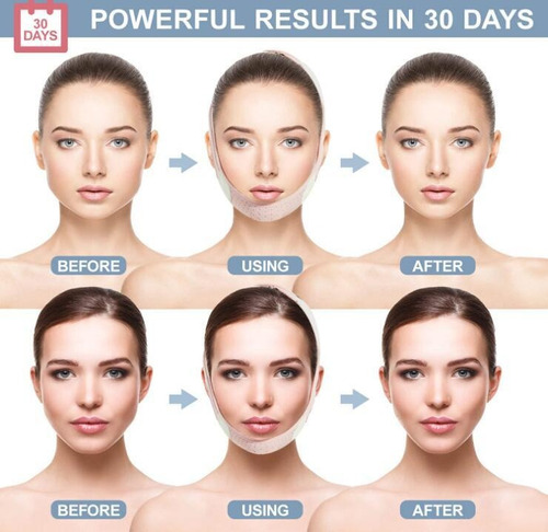 Vendaje De Estiramiento Facial V-line Slim Chin