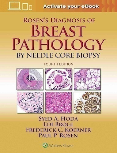 Rosen S Diagnosis Of Breast Pathology By Needle Core Biopsy