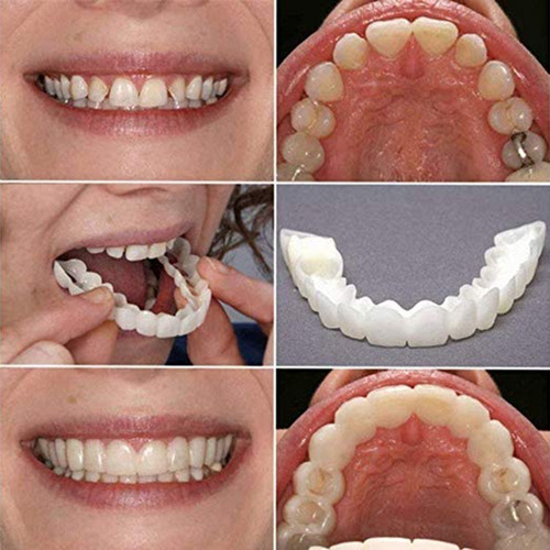 Br 1 Par De Dentes Cosméticos Temporary Smile Fit Indent