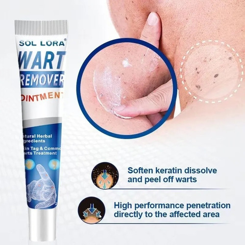 Pomada, Creme, Removedor De Verrugas, Manchas