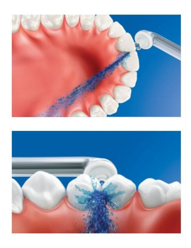 Imagen 3 de 5 de Accesorio Boquilla Interdental Philips Hx8032 Airfloss