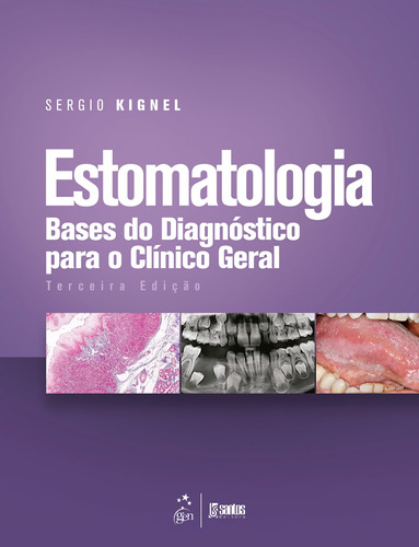 Estomatologia - Bases do Diagnóstico para o Clínico Geral, de KIGNEL, Sergio. Livraria Santos Editora Comércio e Importação Ltda., capa mole em português, 2020