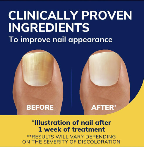 Kit De Recarga De 10 Ml Para Líquido Revitalizador De Unhas