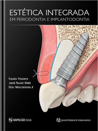 Estética Integrada Em Periodontia E Implantodontia