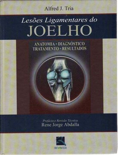 Libro Lesoes Ligamentares Do Joelho 01ed 02 De Tria Alfred J