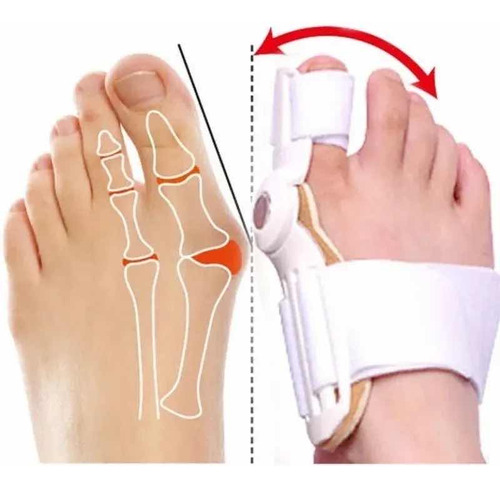 Ferula Corrector De Juanetes Hallux Valgus Ortesis