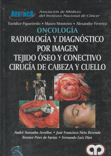 Radiologia Y Diagnostico Por Imagen Tejido Oseo Y Conectivo