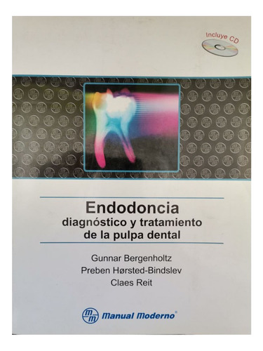 Endodoncia. Diagnóstico Y Tratamiento De La Pulpa - Outlet