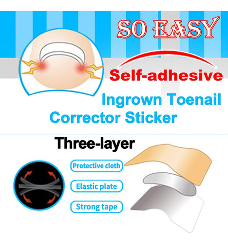 Xfw2 Toe Corrector Stickers Fixer Herramienta De 5 Hojas