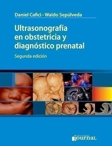 Ultrasonografía En Obstetricia Y Diagnóstico Prenatal Ed.2º