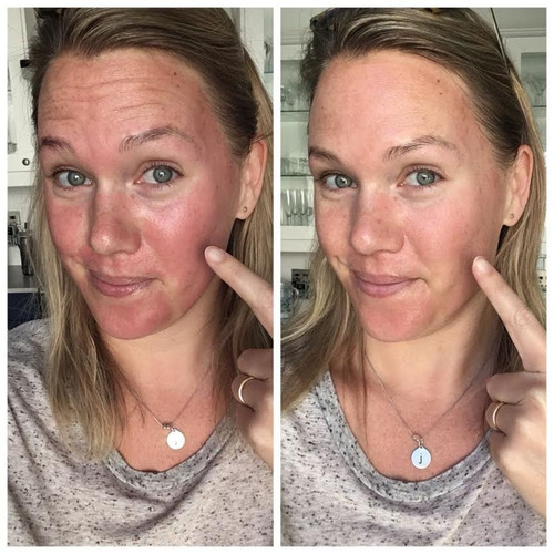 Skinceuticals Phyto Corrective | Correct 30 Ml