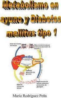 Metabolismo En Ayuno Y Diabetes Mellitus Tipo 1 - Mario R...