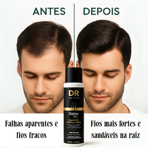 Shampoo 220ml Fortalecedor Para Queda Cabelo Secos C Biotina