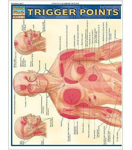 Trigger Points (quick Study Academic) - Barcharts,.., De Barcharts, I. Editorial Quickstudy En Inglés