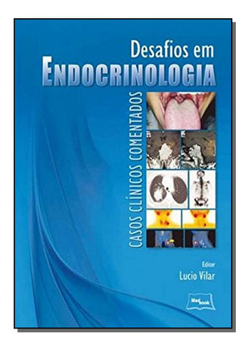 Libro Desafios Em Endocrinologia Casos Clinicos Coment De Vi