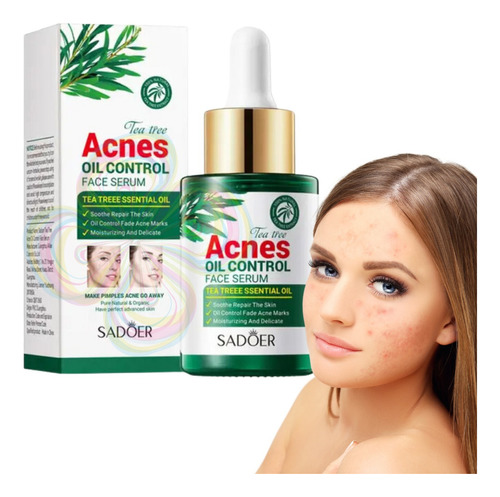 Serum Cuidad Facial Ácido Salicílico Té Verde Control Acné F Tipo De Piel Todo Tipo De Piel