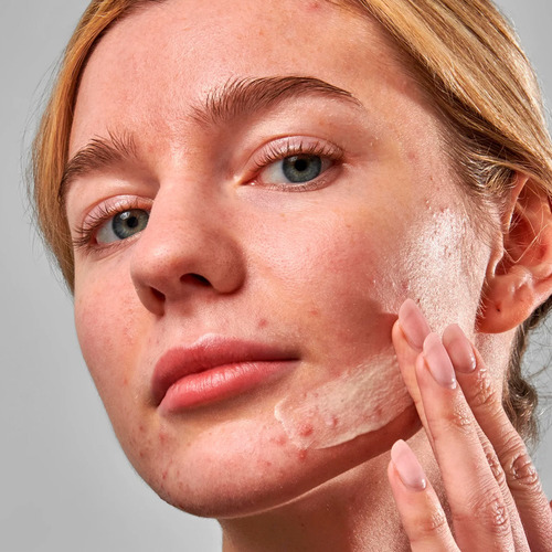The Inkey List Acne Clearing Moisturizer