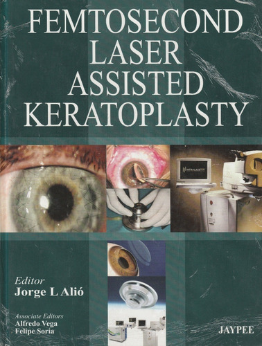 Femtosecond Laser Assisted Keratoplasty Jorge L Alió