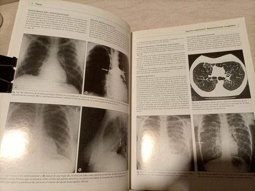 Libro. Imágenes Radiologicas Clínicas, Texto, Atlas. (Usado)