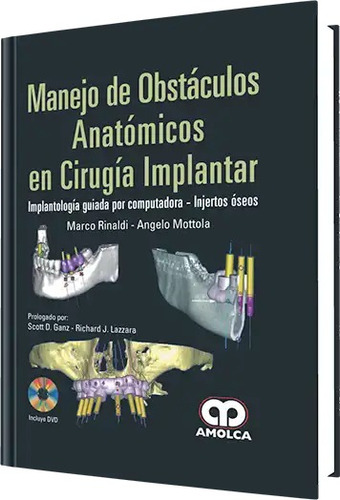 Manejo De Obstáculos Anatómicos En Cirugía Implantar