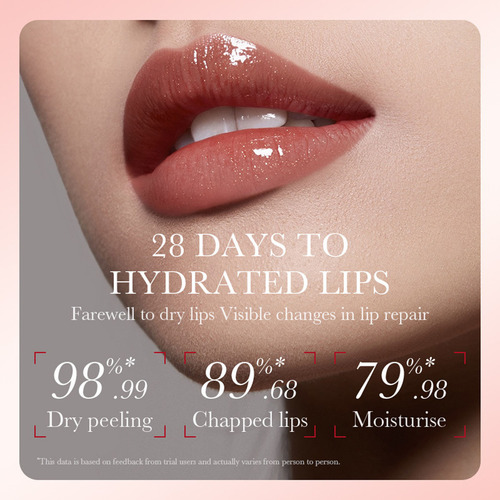 Creme Hidratante Clareador Para Lábios - Lip Mois Seguro E C