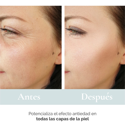Imagen 8 de 10 de Pack Sérum Acido Hialurónico Y Gel Contorno De Ojos
